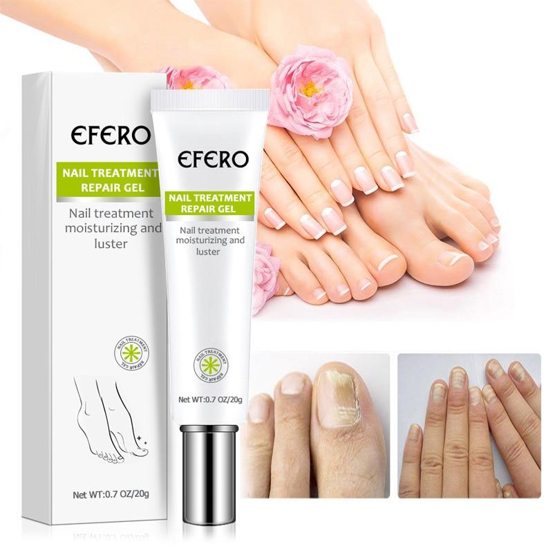 Efero Nagelbehandelingsgel (1+1 GRATIS) | 0 | MERVADO HOME